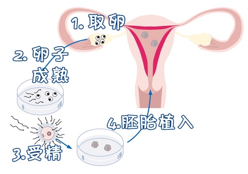 三代供卵试管平台